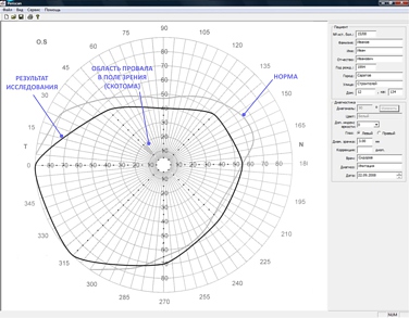 Программное обеспечение Periscan