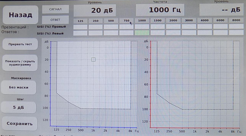 Тест SISI Stern Otoscan Pro 202