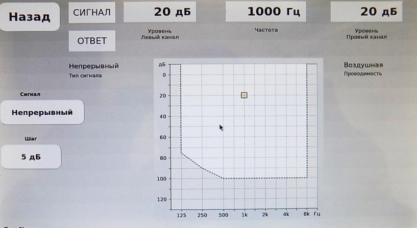 Тест Stenger Stern Otoscan Pro 202