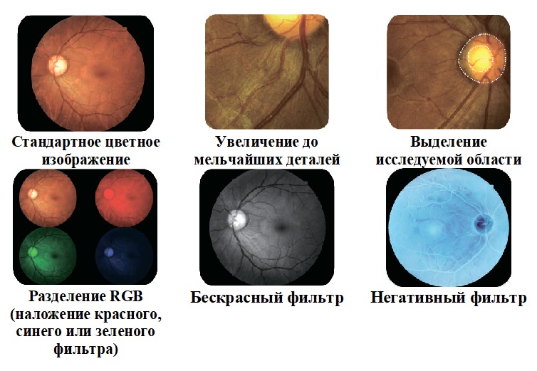 Crystalvue NFC-700 фильтры и режимы