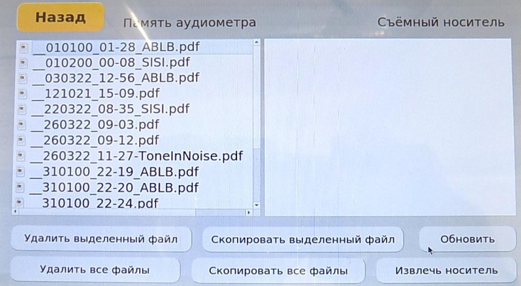 Выгрузка данных на съёмный носитель Stern Otoscan Pro 202