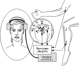 МнДЭП и ОГОЛОВЬЕ