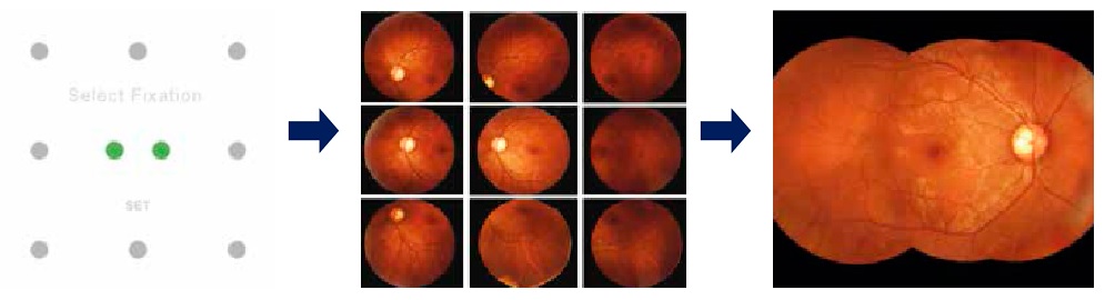 Crystalvue NFC-700 увеличение и визуализация сетчатки