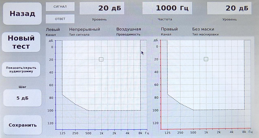 Тест ABLB Stern Otoscan Pro 202
